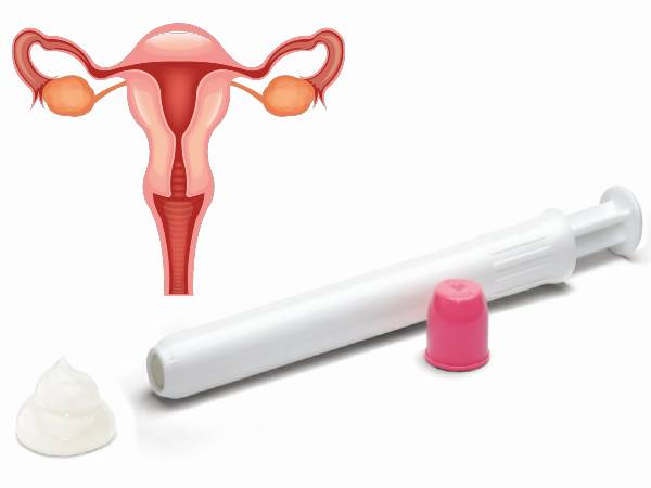 யோனி கருத்தடை ஜெல் என்றால் என்ன?