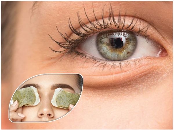 reduce-puffy-eyes-with-these-quick-home-remedie-in-tamil reduce-puffy-eyes-with-these-quick-home-remedie-in-tamil