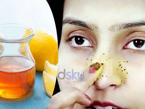 Homemade Honey Face Packs To Get Rid Of Whiteheads In Tamil Homemade Honey Face Packs To Get Rid Of Whiteheads In Tamil