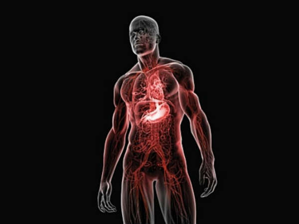 வீக்கம் என்றால் என்ன?