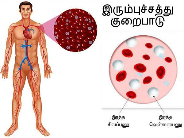 இரும்புச்சத்து குறைபாடு இரும்புச்சத்து குறைபாடு