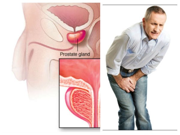 புரோஸ்டேட் ஆரோக்கியம் மேம்படும்