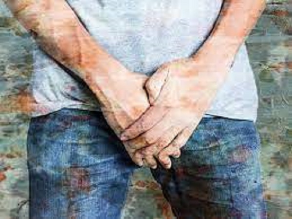 வீக்கம் இருக்காது