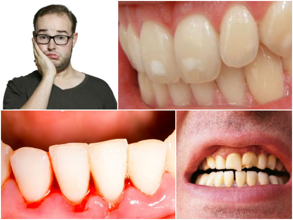 How To Prevent Common Oral Health Problems How To Prevent Common Oral Health Problems