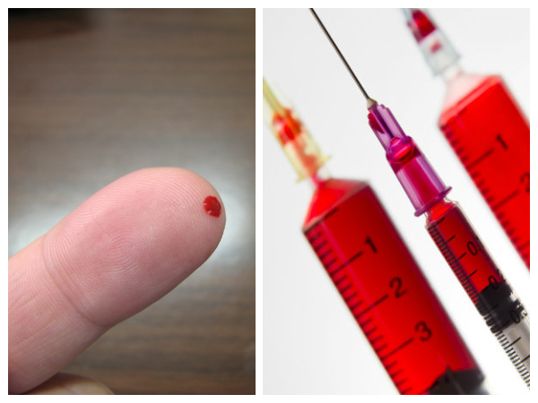 வைட்டமின் டி மற்றும் கால்சியம் சோதனை வைட்டமின் டி மற்றும் கால்சியம் சோதனை