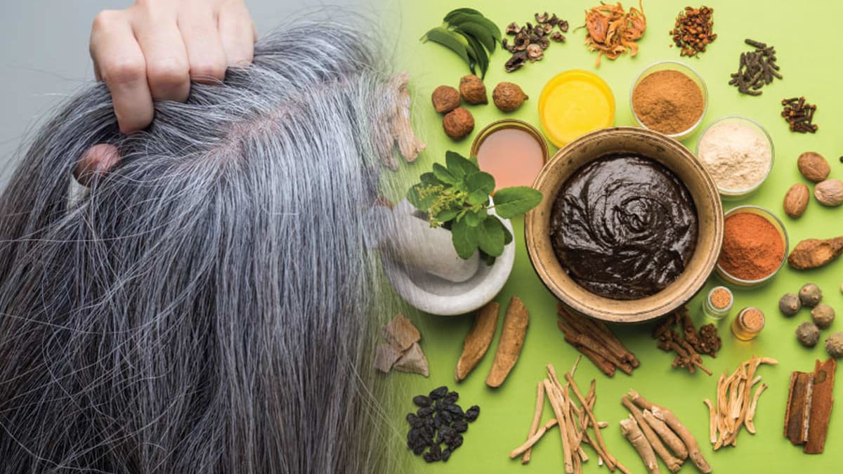 White Hair Remedies: Ayurvedic Remedies To Get Rid Of Grey Hair In Tamil White Hair Remedies: Ayurvedic Remedies To Get Rid Of Grey Hair In Tamil