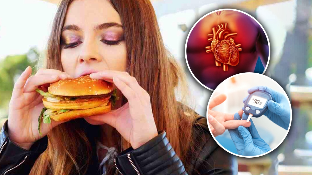 World Obesity Day: Obesity can increase heart disease, diabetes risk and more in tamil World Obesity Day: Obesity can increase heart disease, diabetes risk and more in tamil