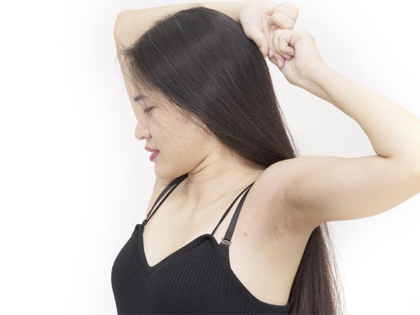 Lifestyle Changes To Treat Dark Underarms in Tamil