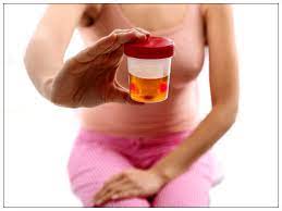 What Does the Smell of Urine Say About Your Health in Tamil