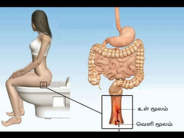 Dr Farooq Adbullah Says About Piles Symptoms, Causes, Treatment