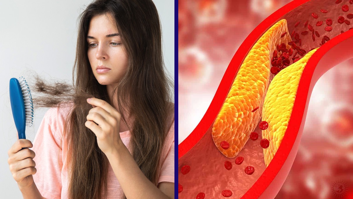 Warning signs of high cholesterol that appears in hair in tamil Warning signs of high cholesterol that appears in hair in tamil