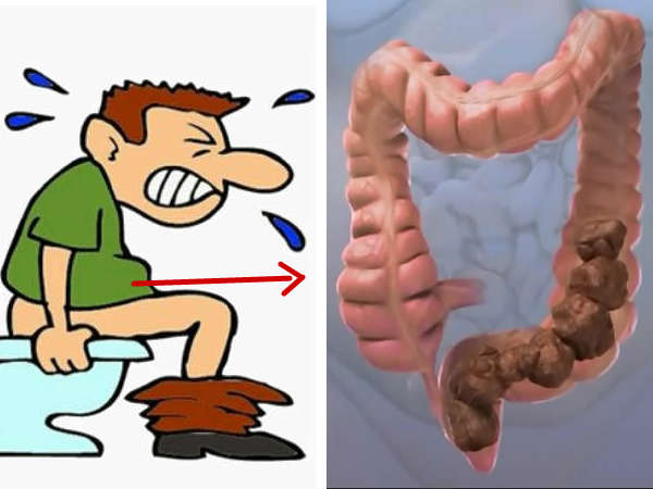 Dehydration Symptoms: Alarming Signs Of Dehydrated Intestines In Tamil