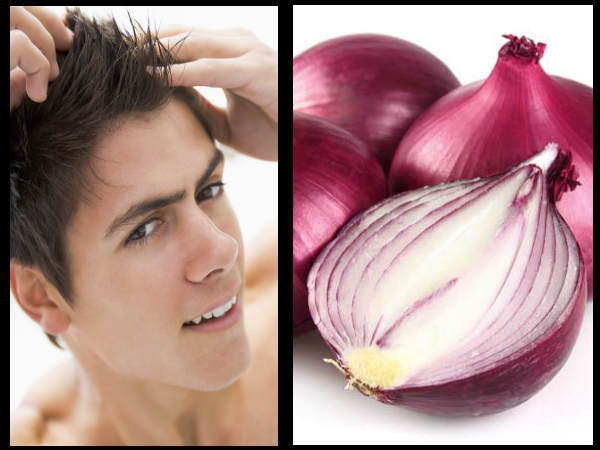 Onion Serum: Home Remedy For Hair Growth In Tamil 