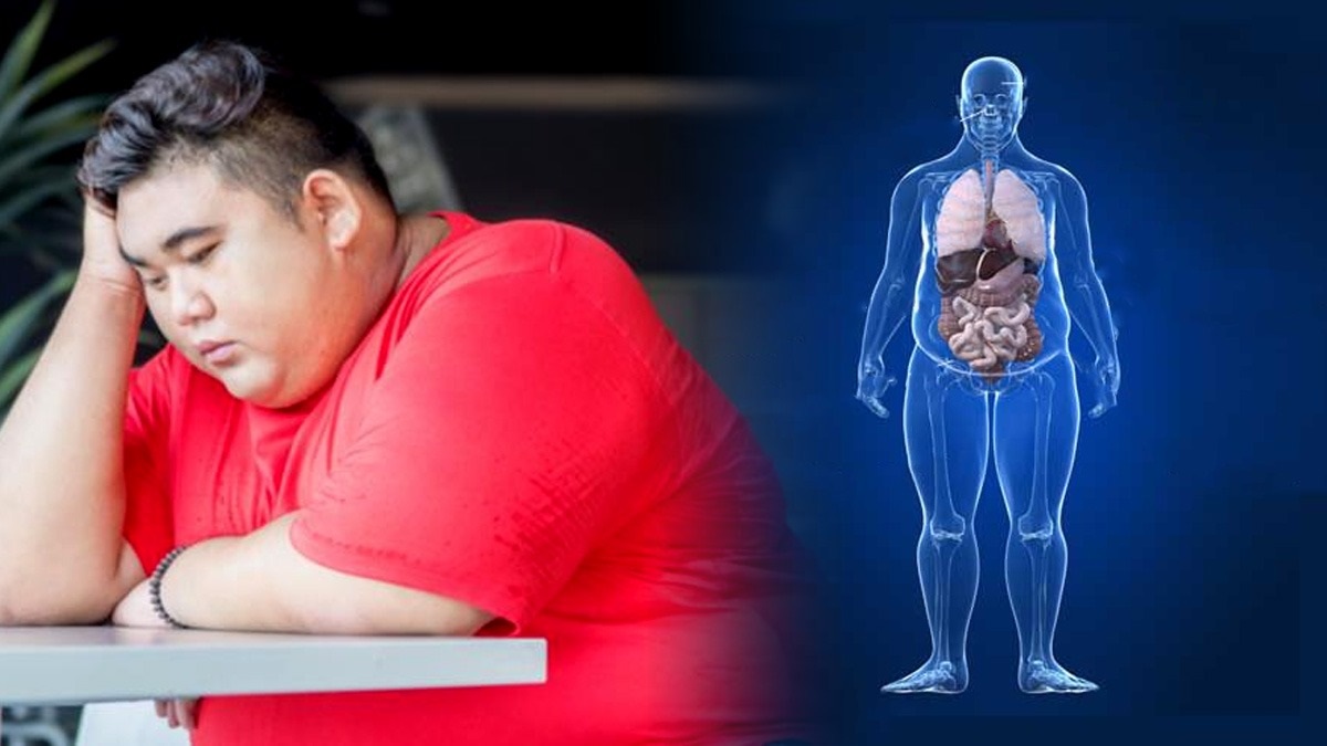 Health Complications Caused by Obesity in Tamil