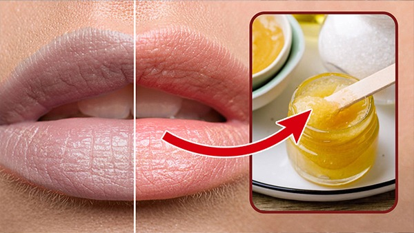 Home Remedies to Get Pink Lips Naturally in Tamil Home Remedies to Get Pink Lips Naturally in Tamil