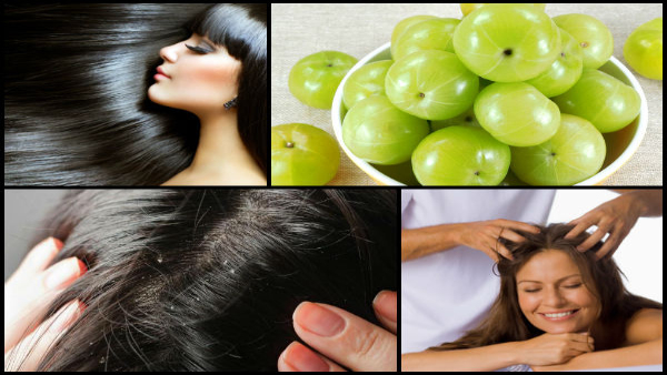 Amla That Do Natural Wonders To Your Hair In Tamil