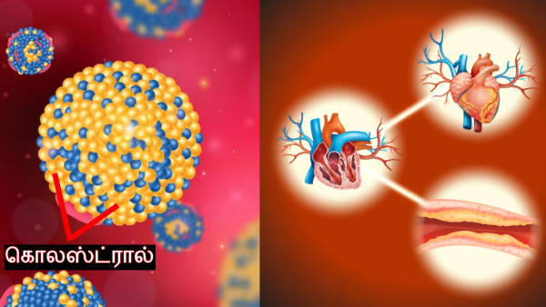 Health Tips: What Happens When Cholesterol Levels Cross 200 In Tamil