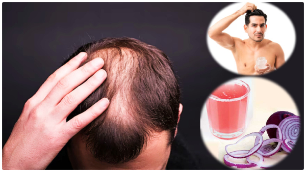Hair Care Tips: DIY Overnight Hair Masks For Men Suffering From Hair Loss In Tamil