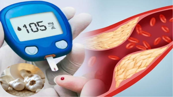 How To Eat Garlic If You Have High Cholesterol Or Diabetes In Tamil