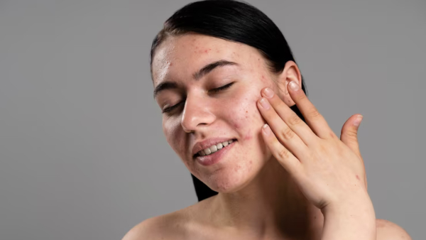 What Is Sebum and Why Does It Build Up on Skin and Hair In Tamil