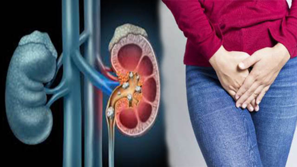Top Six Stages Of Serious Kidney Disease In Tamil