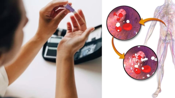 Tips To Manage Sudden Blood Sugar Spikes Post Meal In Tamil