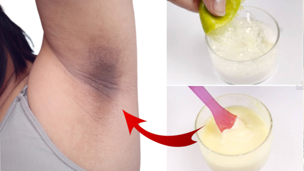 Skin Care Tips: How To Use Baking Soda to Get Rid of Underarm Darkness In Tamil