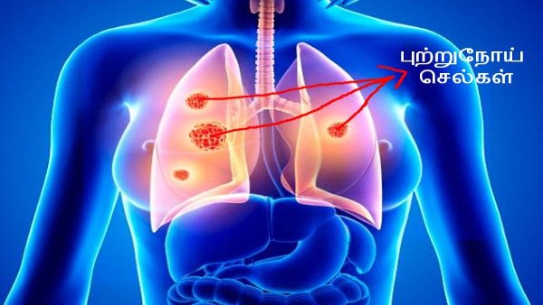 Minerals And Vitamins For Help Cancer Prevention In Tamil 