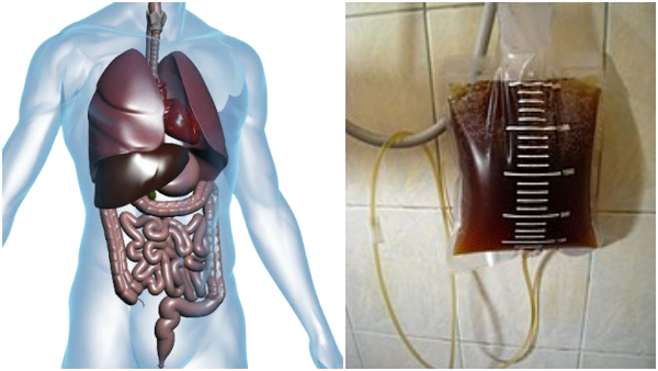 Health Tips: What is Coffee Enema? Benefits and Risks In Tamil