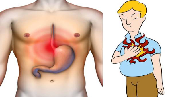 Why Does Burning Sensation Comes After Every Meal in Tamil