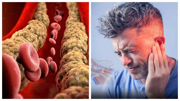 Symptoms Of High Cholesterol In Your Ears In Tamil 