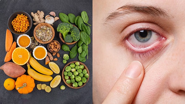 Important Nutrients To Protect Your Eyes Against Infections in Tamil