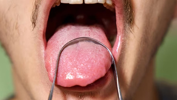 Benefits Of Tongue Scraping For Oral Hygiene In Tamil 