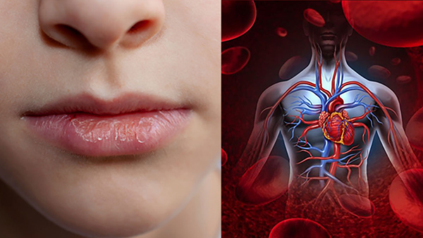 Warning Signs Your Lips Give You About Health In Tamil 