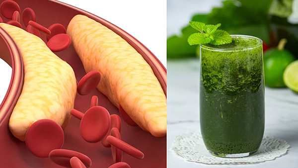 Drinking Vegetable Juice May Reverse Bad Cholesterol In Tamil Drinking Vegetable Juice May Reverse Bad Cholesterol In Tamil