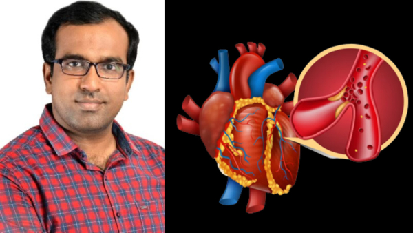 Dr Farooq Abdulla explains How To Detect Blocked Blood Vessels In Early In Tamil