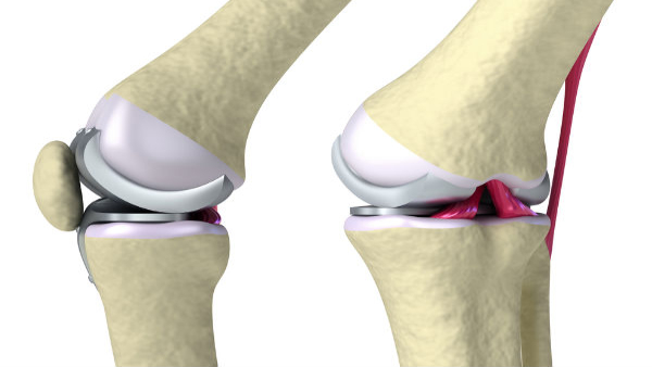 best foods for cartilage growth in tamil