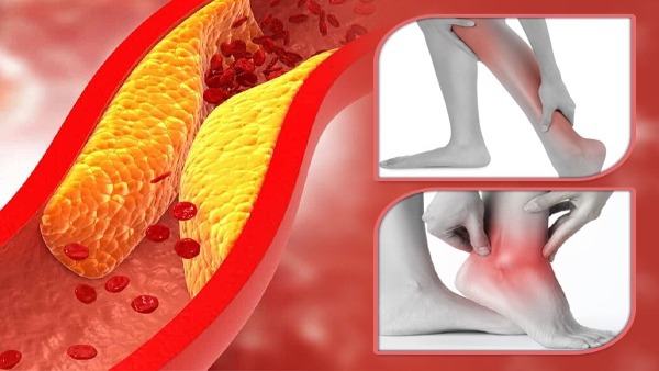 Dangers Of Uncontrolled High Cholesterol In Tamil 