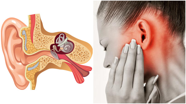 Causes Of Headache Behind The Ear In Tamil