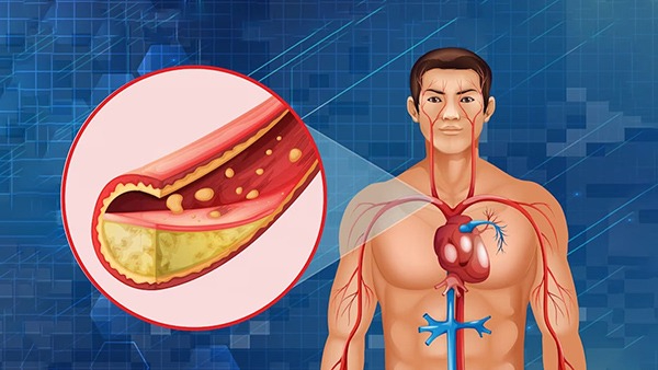 Home Remedies To Lower Bad Cholesterol At Home in Tamil