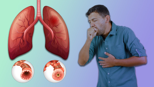 Check out the most prominent causes of lung cancer in non-smokers.