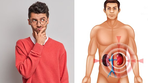 Myths and Facts About Kidney Stones in Tamil