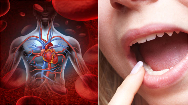 Signs of High Blood Sugar in Mouth in Tamil