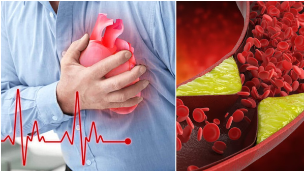 Cholesterol Lowering Drinks: Beverages That Reduce Cholesterol And Prevent Heart Attacks In Tamil