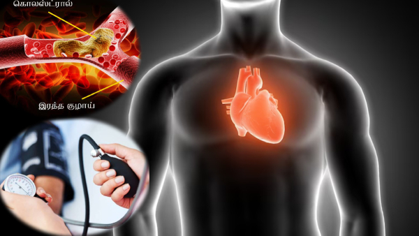 Pickles Side Effects: How Do Pickles Affects Your Health In Tamil 