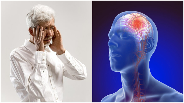 Why Vision Problems Occur After A Stroke In Tamil Why Vision Problems Occur After A Stroke In Tamil