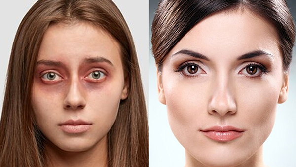 The 10-Minute Under Eye Bag Hack In Tamil 