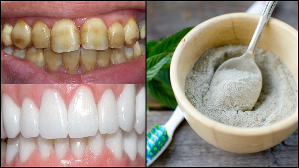 Homemade Ayurvedic Powder For Teeth Whitening In Tamil