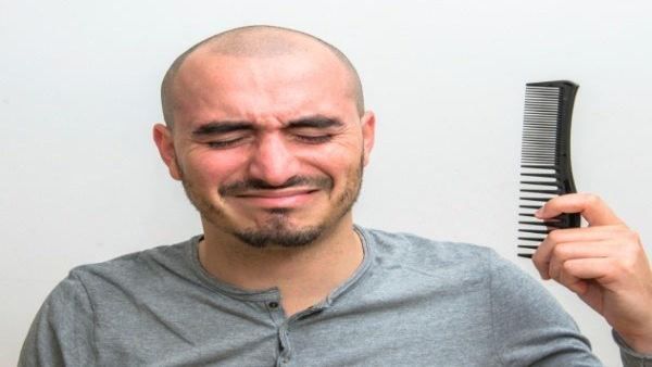 Bald Treatment: Scientists say injections of fat from your thighs could reverse the process in Tamil Bald Treatment: Scientists say injections of fat from your thighs could reverse the process in Tamil