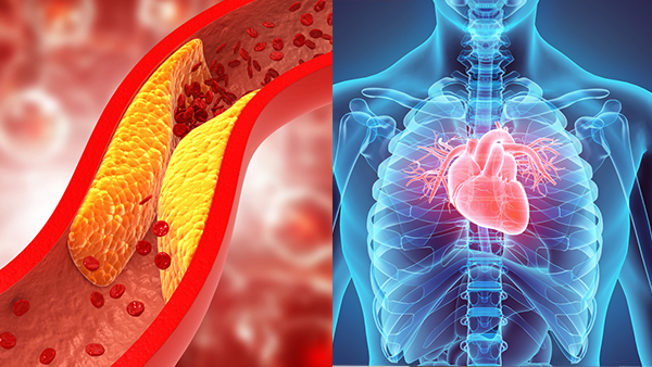 How This Simple Tea Can Reduce Bad Cholesterol Levels And Improve Heart Health In Tamil How This Simple Tea Can Reduce Bad Cholesterol Levels And Improve Heart Health In Tamil